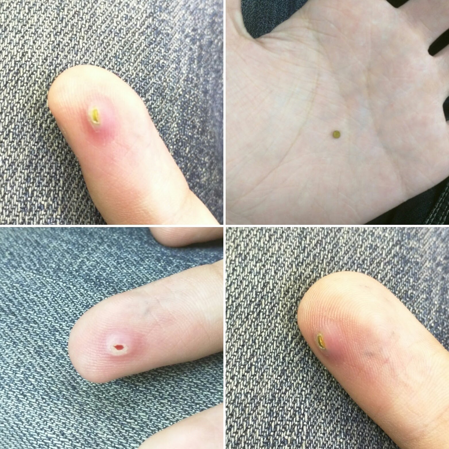 m31 finger magnet rejection