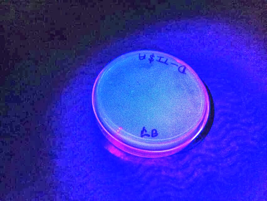 pglo transformation lab write up Biotechnology explorer™ pglo introduction to transformation in this lab genetic transformation occurs when a cell takes up. pglo transformation lab write up Biotechnology explorer™ pglo introduction to transformation in this lab genetic transformation occurs when a cell takes up.