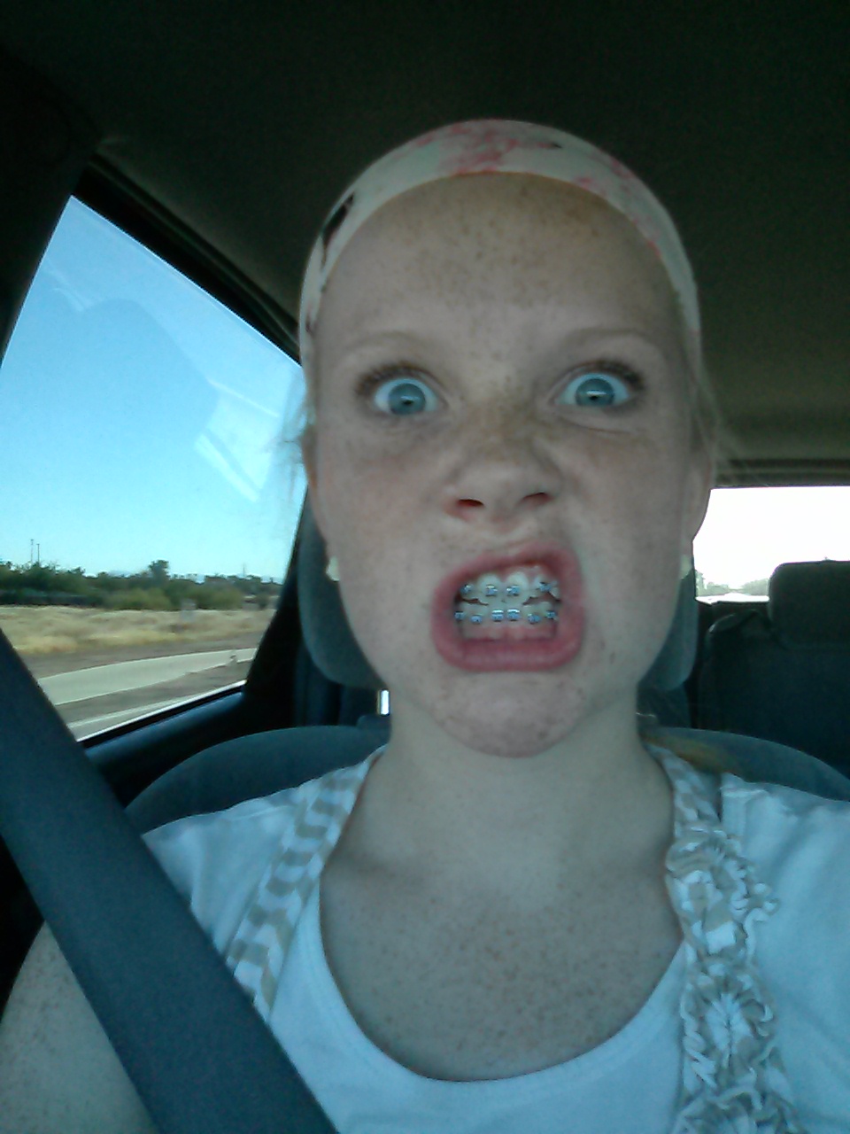 Four girls for us braces