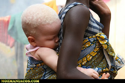 crianças albinas africanas