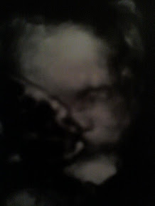 Ultrasound #9 (2).