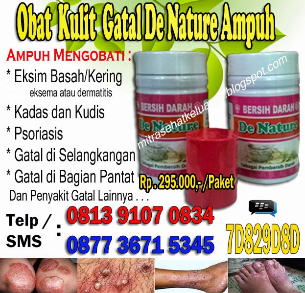 uh mengatasi eksim kering dan basah gatal bandel menahun uh mengatasi eksim kering dan basah gatal bandel menahun