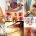 Obat Wasir Alami Terbukti Manjur thumbnail