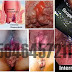 Pengobatan Ambeien (Wasir) Ala Dokter Herbal thumbnail