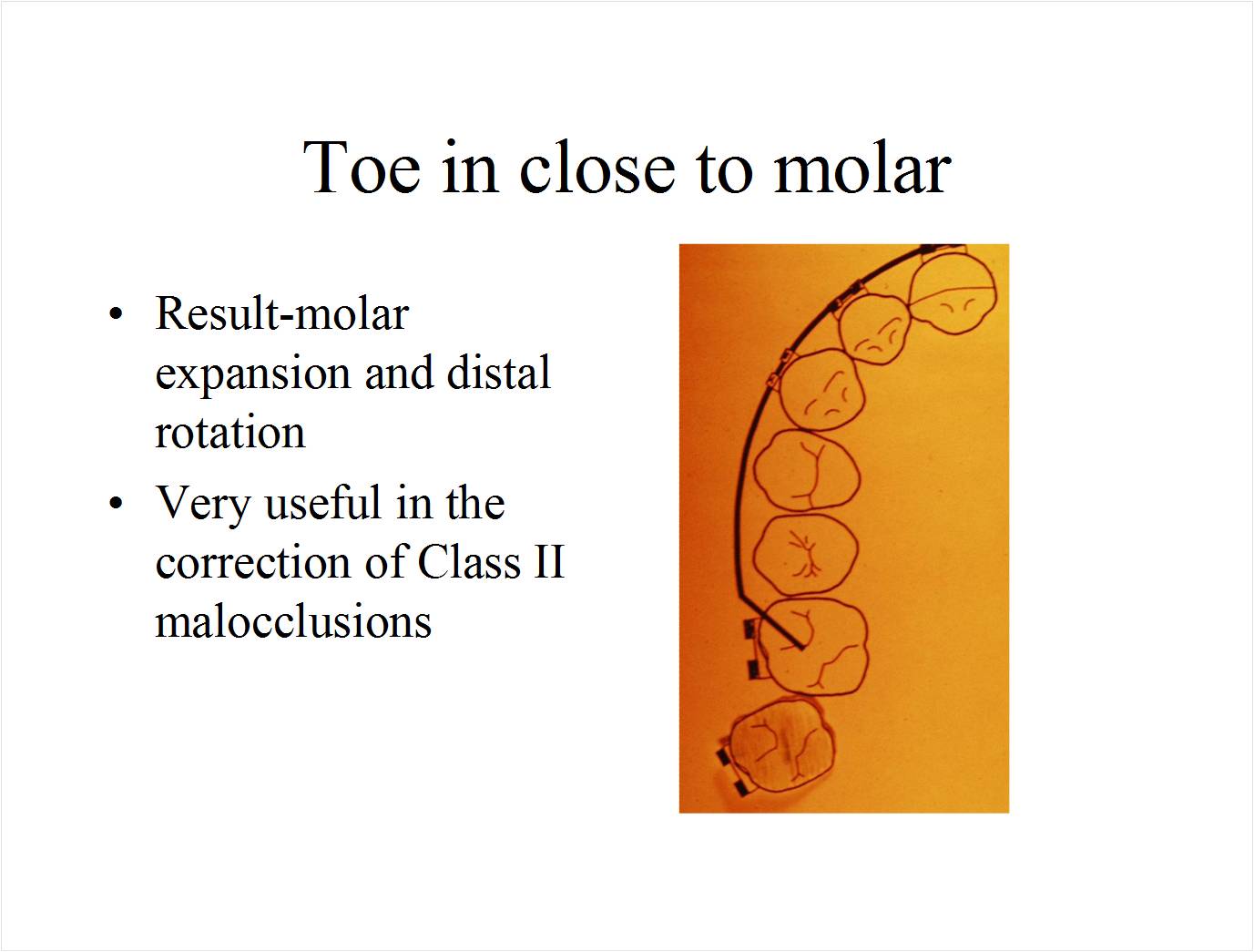 practical orthodontics Diagnosis and treatment of mesially rotated