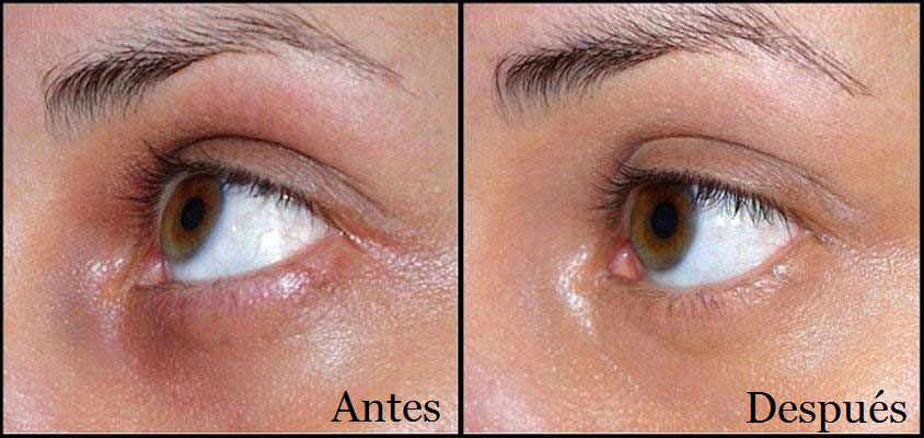 Las máscaras para la cutis llana elástica