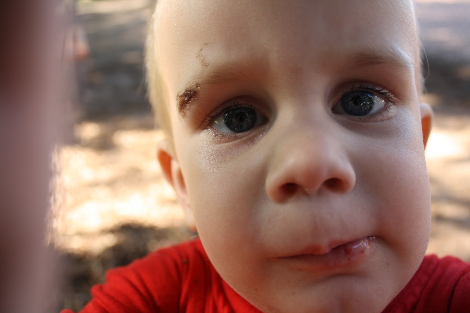 Cut On Eye