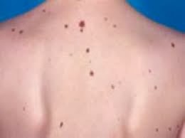 sagligin sirri urunler sigiller et benleri