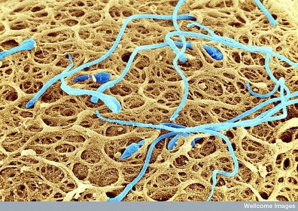 of sperm Regeneration of sperm Regeneration