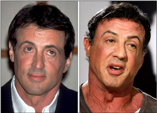 Chatter Busy: Sylvester Stallone Plastic Surgery