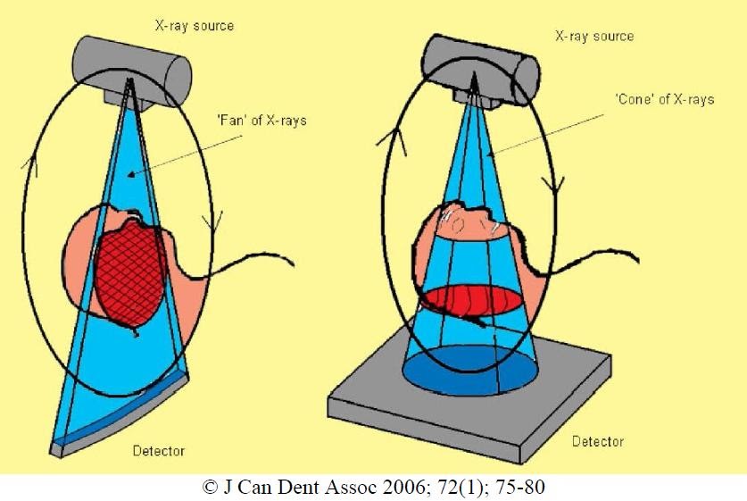 The Endo Blog Cone Beam Computed Tomography (CBCT) A Proper Introduction