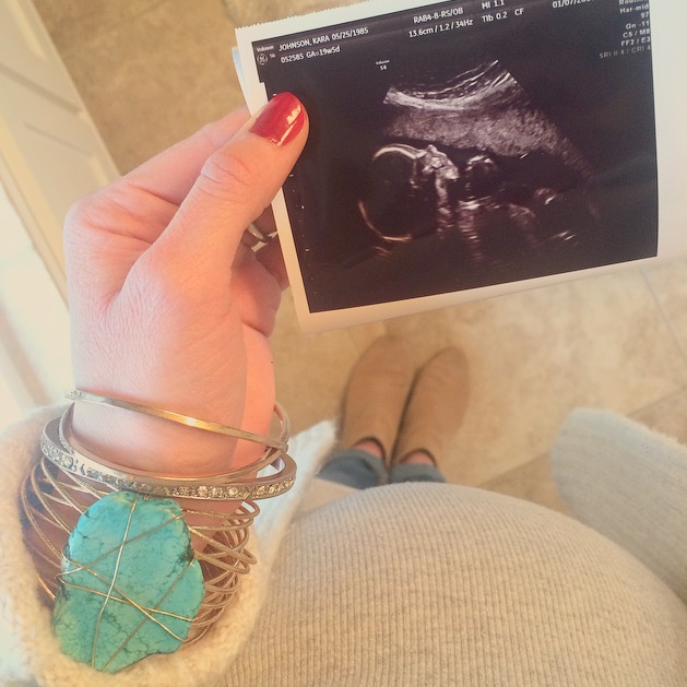 karas stories 20 weeks baby size at 20 weeks