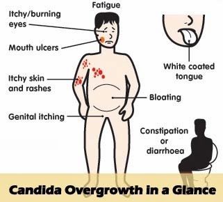 candida-overgrowth-in-a-glance.jpg