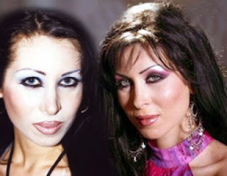 صور الفنانات قبل وبعد عمليات التجميل صور الفنانات قبل وبعد عمليات التجميل