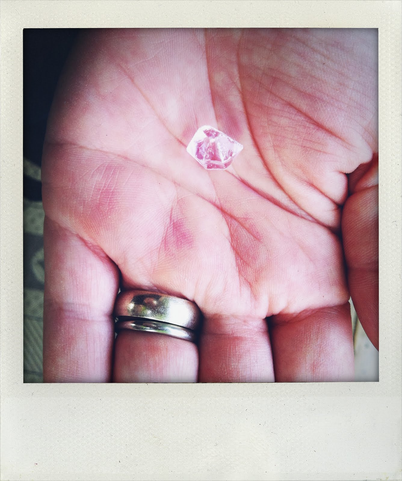 most days i win Nosebead removal tutorial