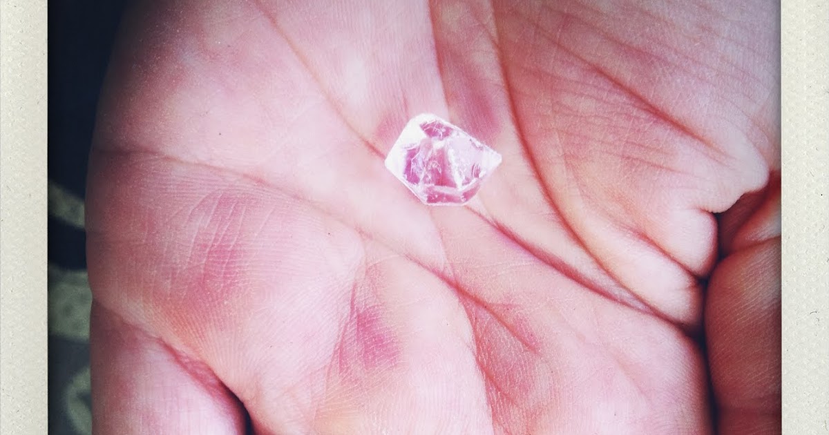 most days i win Nosebead removal tutorial