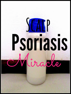 scalp psoriasis