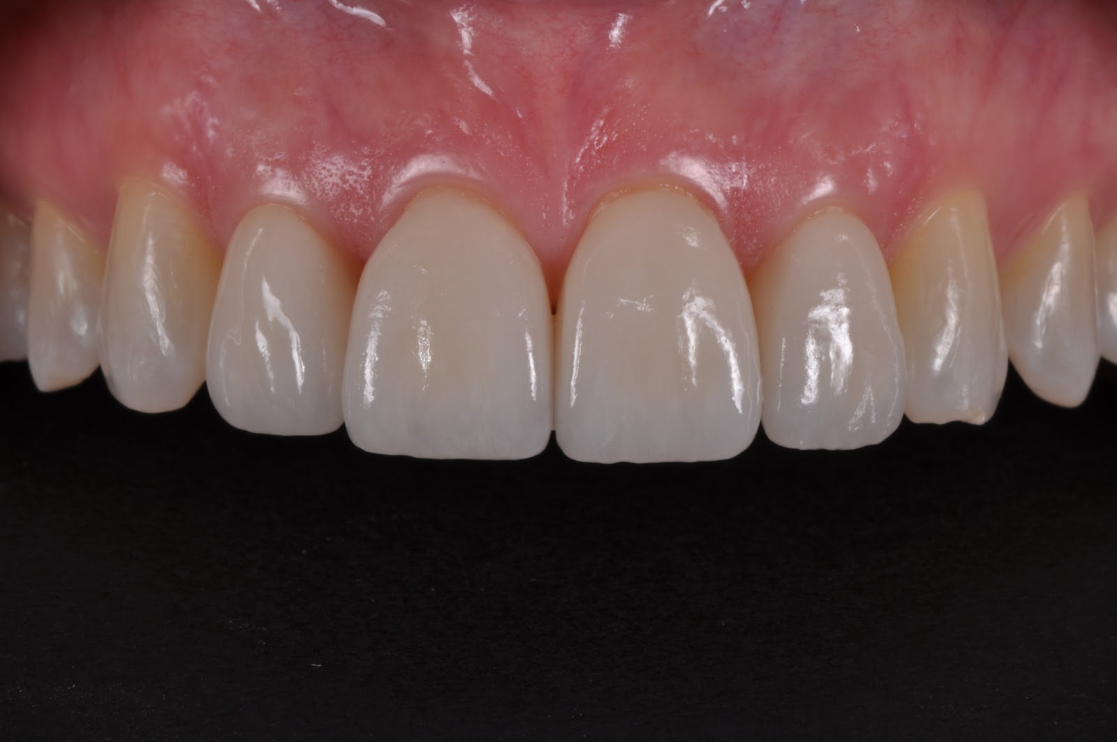 Dental Photography Pearls For Better Images Instantly An easy (and