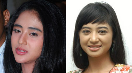 Dewi Persik Operasi Plastik | Dunia Operasi Plastik