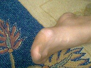 ayak fetis