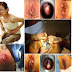 Obat Dubur Bengkak,Panas, Perih Dan Gatal2 thumbnail