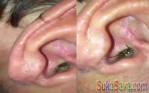 Seekor Laba-Laba Bersarang Di Telinga Orang Ini Seekor Laba-Laba Bersarang Di Telinga Orang Ini