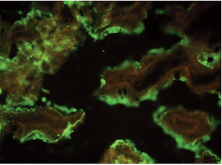 Hình 1: Xác định coronavirus DEP bằng miễn dịch huỳnh quang (mầu xanh) trên tiêu bản đông lạnh ruột non lợn con ngay khởi đầu của bệnh, nhờ kháng thể polyclonal đặc hiệu (X 100, cliché LDA 22)