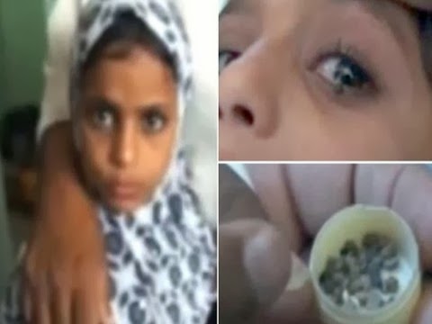 Misteri Gadis Menangis Keluar Air Mata Batu Saadiya Saleh
