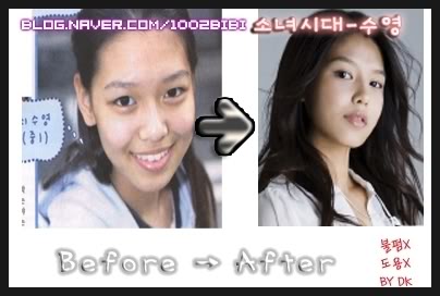 Sunny Snsd Plastic Surgery on Tumblr Pics         Snsd  Girls Generation  Before Surgery