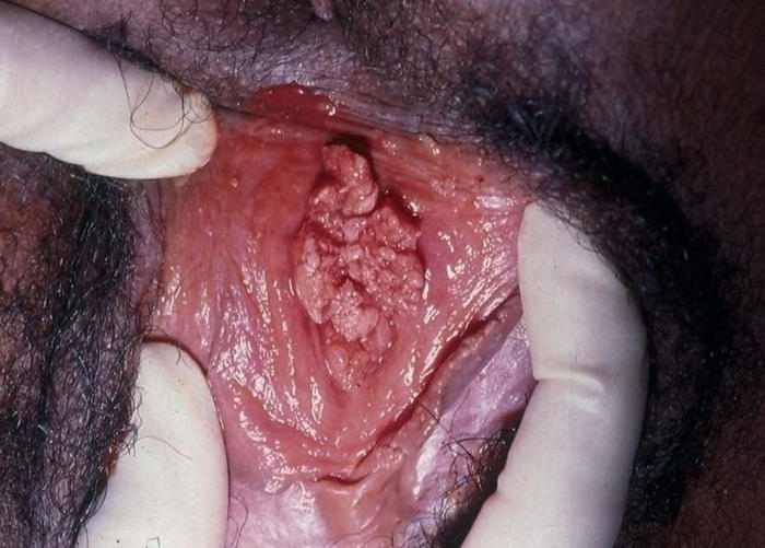 Hairy lesbian cum drinkers Cum without penetration videos