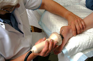 Heel Spur Relief - Surgery - Health and Fitness