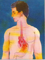 Refluxo gastroesofágico corpo humano
