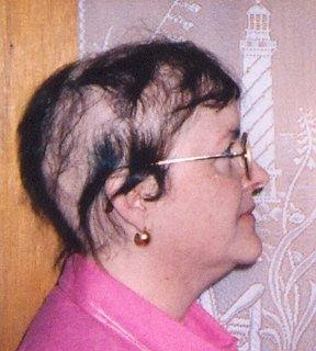 why is my s hair falling out hair falling out hair falling out 8 reasons may lose their hair ahava emunah why is my s hair falling out hair falling out hair falling out 8 reasons may lose their hair ahava emunah