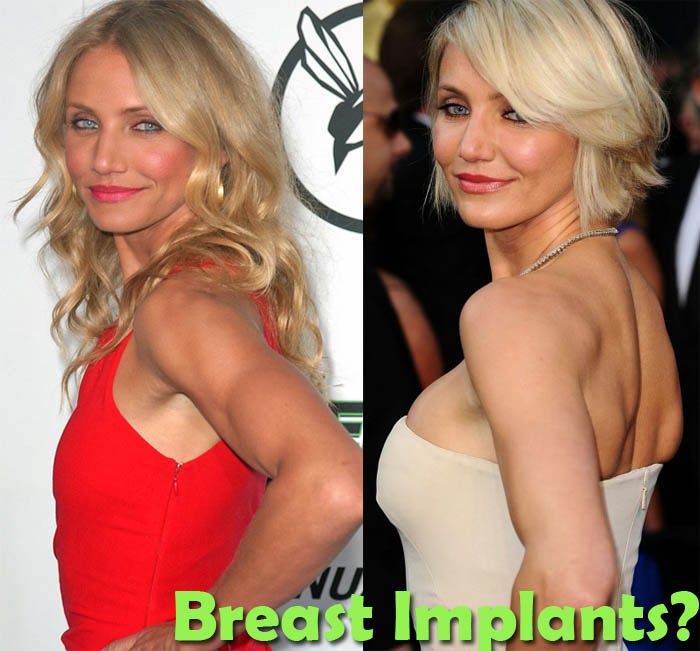 actresses who have had breast implants removed mens adults toys mare pussy