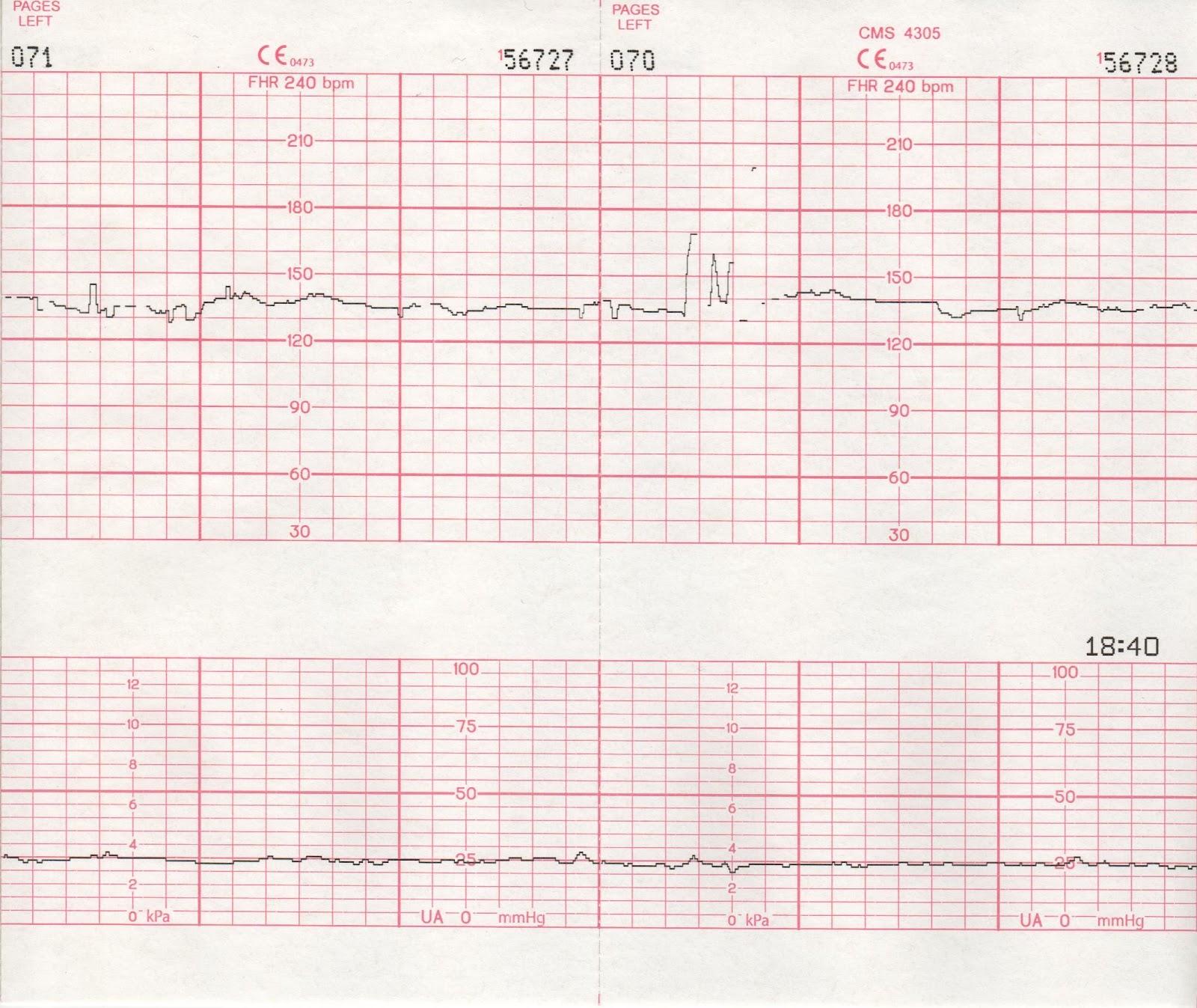 Baby's Heartbeat Our first baby