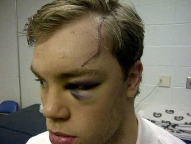 Taylor hall porn — photo 9
