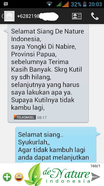 TESTIMONI PENYAKIT KUTIL KELAMIN TESTIMONI PENYAKIT KUTIL KELAMIN
