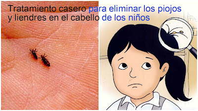 El medio público para los bulbos de los cabello