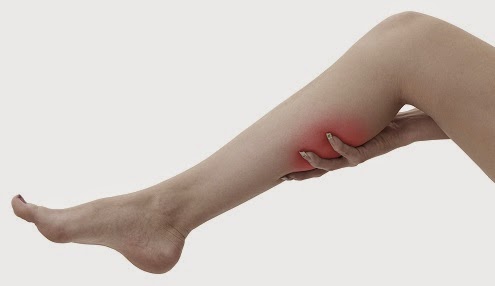 Solusi Mengatasi Kram Pada Kaki Lifestyle