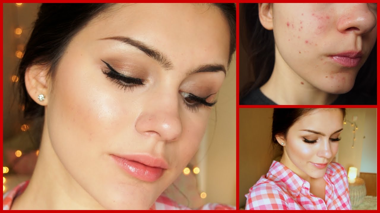 Make-up essentials for acne prone skin Make-up Essentials for Acne Prone Skin