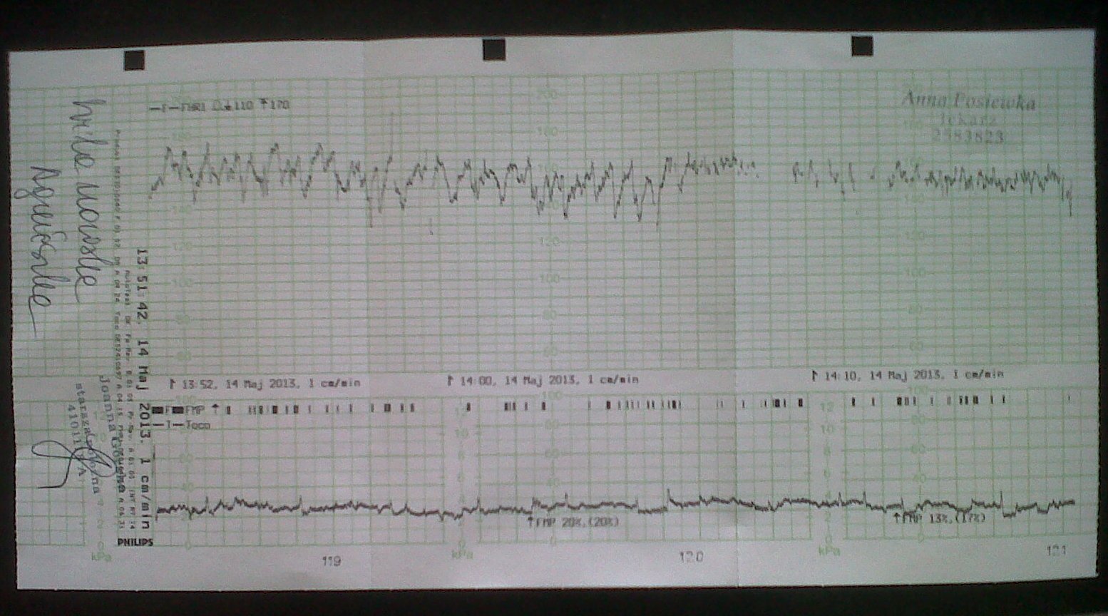 WilanFamily 37 tydzień i zaczynamy KTG