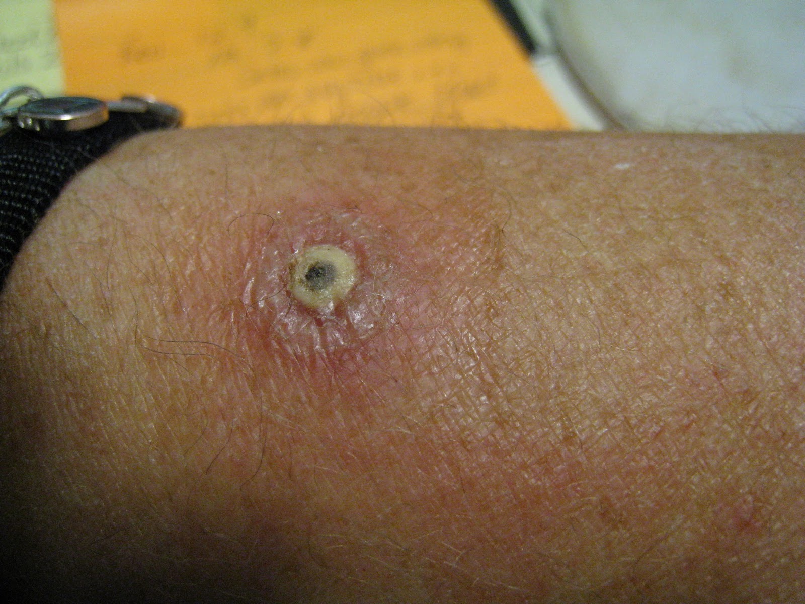 ConTAGEous Health Good spit vs. Bad spit! AND...removal of unhealthy