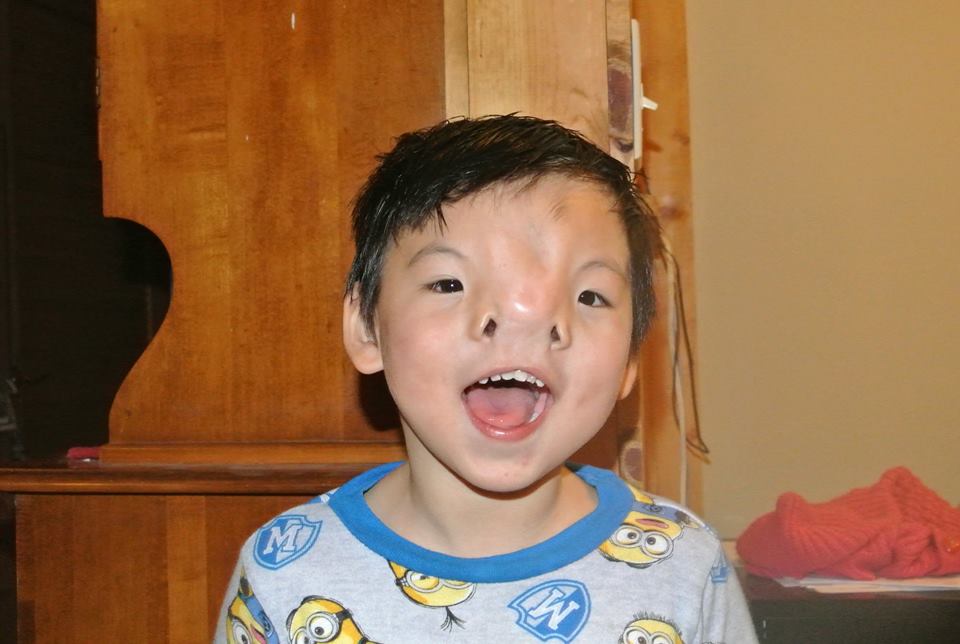 Navigating the Stillness. Surgery preparation, comparison and