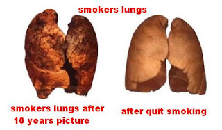 smokers lungs after 10 years pictures