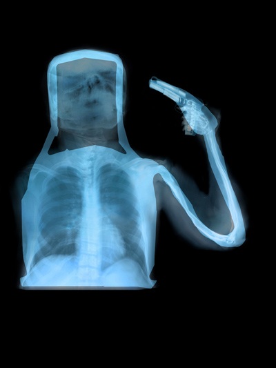 ahmed mater evolução homem raio-x posto gasolina