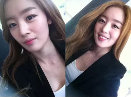 Kpkf Female Idols Plastic Surgery Netizen Nation Onehallyu