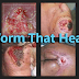 Worm That Heals