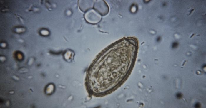 Parasitology 101 Clonorchis sinensis