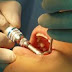 Pessoas com deficiência têm atenção odontológica em Ceilândia