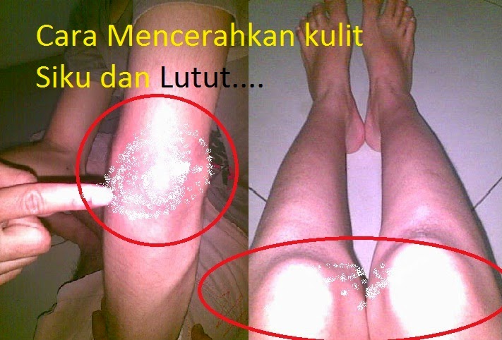 Dr Oz Tips Cerahkan Kulit Siku dan Lutut Dr Oz Tips Cerahkan Kulit Siku dan Lutut